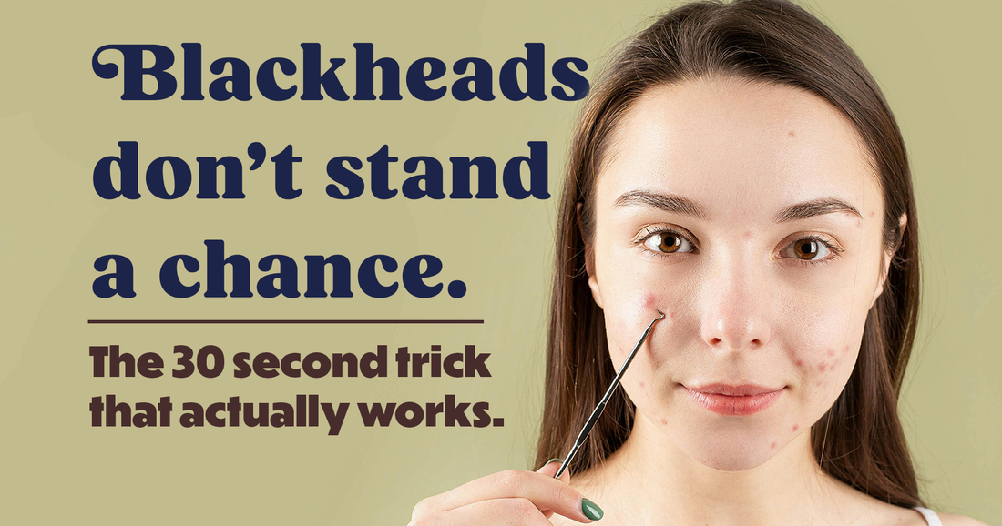 Blackheads Don't Stand a Chance — this 30 Second Trick Works!